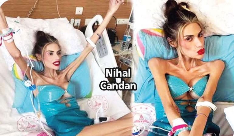 Anoreksiya ve 23 kiloyla yok olan gencecik bir hayat