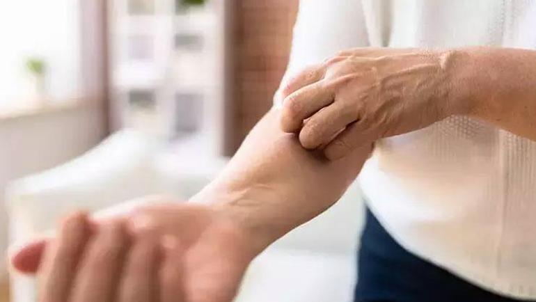 Kan grubunuz sivrisinekleri çekiyor 24 saatten fazla süren ateş ciddiye alınmalı