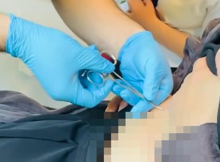 Halsizlik şikayetiyle gitti, hayatının şokunu yaşadı Karnından çıkana inanamadı