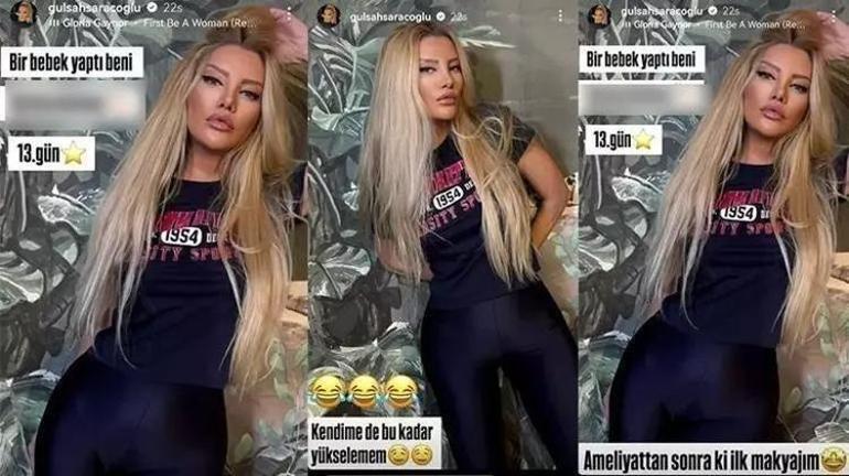 9 saat süren estetik yaptırmıştı Gülşah Saraçoğlu ortaya çıktı