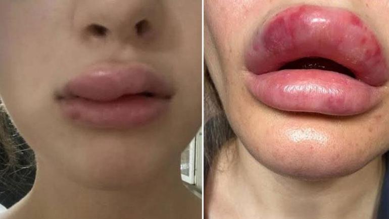 Jandarma sahte botoks şebekesini çökertti Sayısız kadın mağdur oldu: Uzman isim tehlikeye dikkat çekti