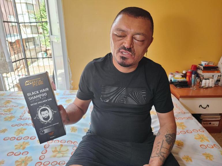 Berberi önerdi diye aldı, 48 saat sonra hayatı kabusa döndü