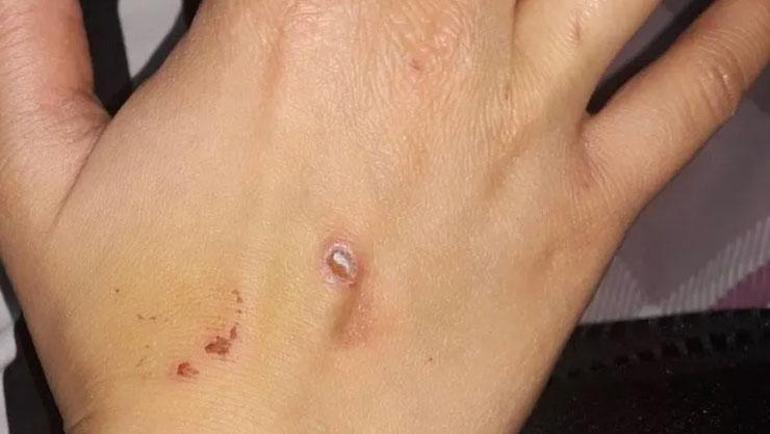 Şiddet gören kadına mahkmeden şok karar Kıskançlığı kusur sayıldı