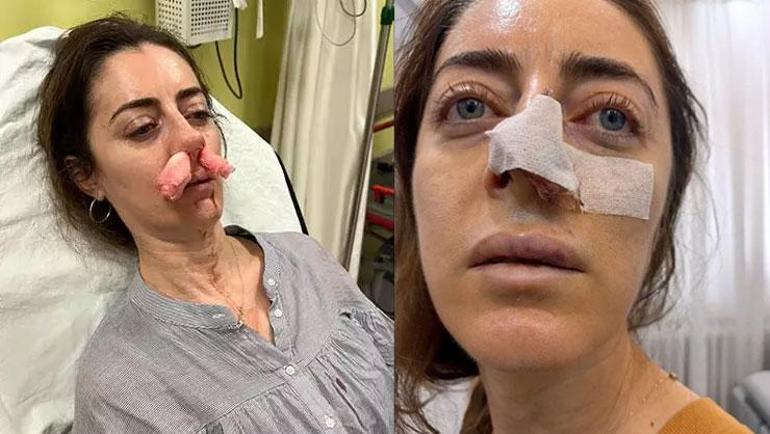Yanlışlıkla yasak aşk mağduru oldu: Eşinin sevgilisi zanneden kadın tarafından kabusu yaşamıştı ‘Otomobil kapısı’ silah sayıldı