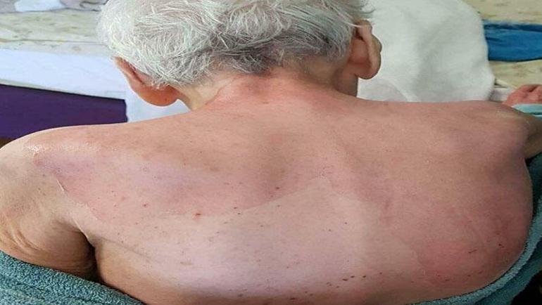 Huzurevinde banyo sonrası şok ölüm Doktora yakalama kararı