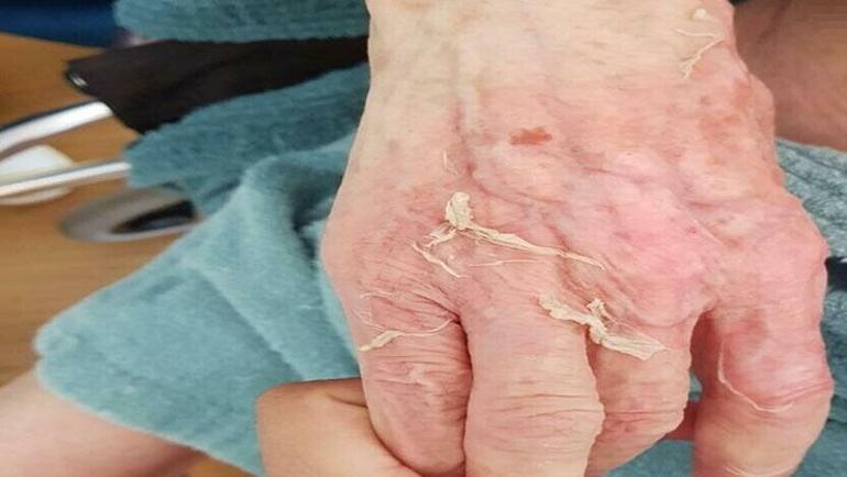 Huzurevinde banyo sonrası şok ölüm Doktora yakalama kararı