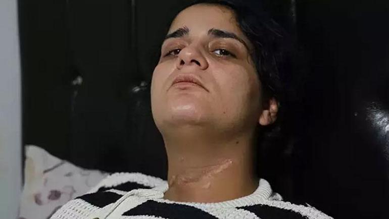 Ayrıldığı eşi cips paketini açarken boğazını kesti: Ölmedin mi sen