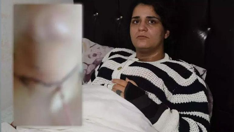 Ayrıldığı eşi cips paketini açarken boğazını kesti: Ölmedin mi sen