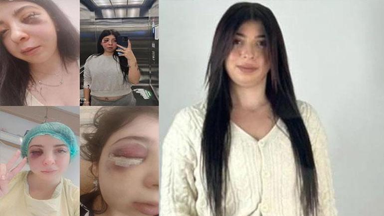 Damlayı sokak ortasında öldüresiye dövmüştü: Tahliye edilen sanık için savcıdan ceza talebi