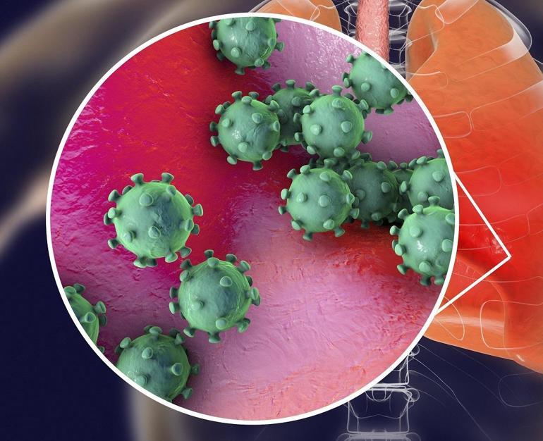 Yıllarca belirti vermeden sinsi sinsi ilerliyor Akciğer kanserinde risk artıyor...