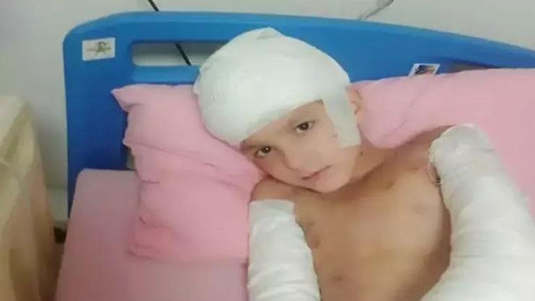 12 yaşındaki Tunahanın hayatını kabusa döndü Sokak köpeği saldırısında aileye rekor tazminat ödenecek