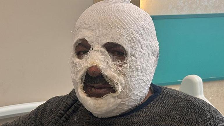 Arkadaşına iyilik yapmak isterken ibretlik oldu Ben yandım kimse yanmasın