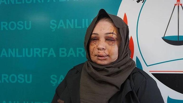 Ankarada eşine dehşeti yaşatan polis tutuklandı Bakanlardan peş peşe açıklama