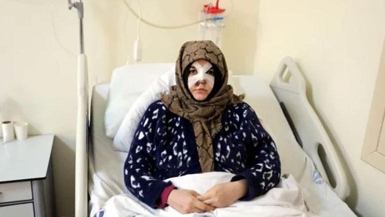 Kaldırım taşıyla saldırdı, Nazlının kabusu oldu: Ayaklarımın üzerinde dursaydım ona dönmezdim