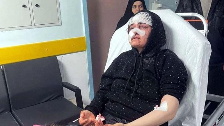 Kaldırım taşıyla saldırdı, Nazlının kabusu oldu: Ayaklarımın üzerinde dursaydım ona dönmezdim