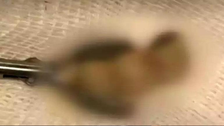 Uyandığında şoke oldu Dişlerini yuttuğunu düşündü, gerçek röntgende ortaya çıktı