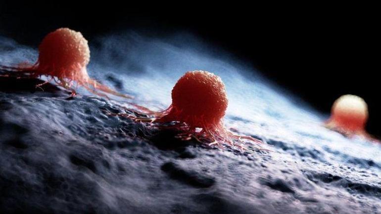 Kanser artık çaresiz değil Düzenli kontroller hayati öneme sahip