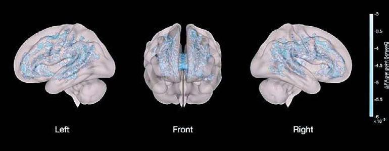 Çocuklarımız büyük bir deneyin içinde: Dijital alzheimer