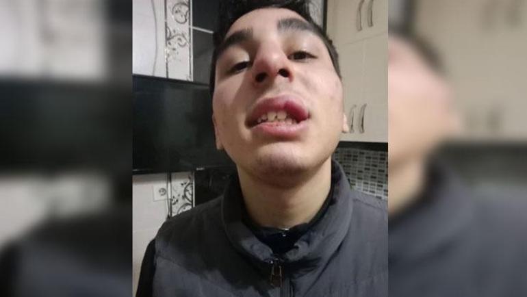 16 yaşındaki çocuğa, arkadaşının babasından sokak ortasında dayak Camiden evine kadar döverek götürdü