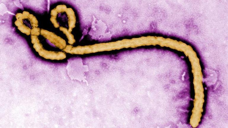 DSÖden acil toplantı: Ebola virüsünün yayılma hızı endişe verici 130 can aldı
