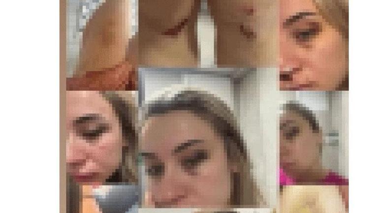 Elif öğretmenin çığlığı sonrası dayak Artık sesimi çıkarmanın vakti geldi