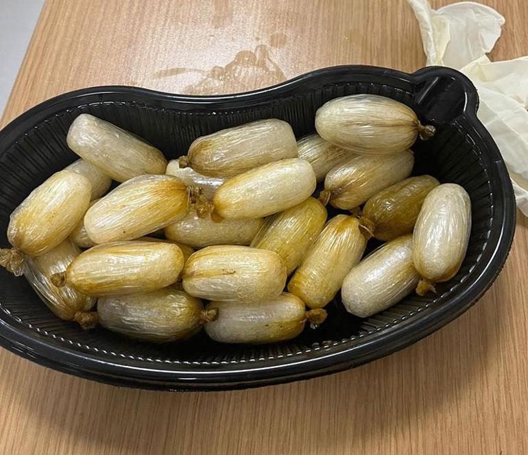 Midesinden 62 paket uyuşturucu çıktı 590 gram metamfetaminle yakalandı