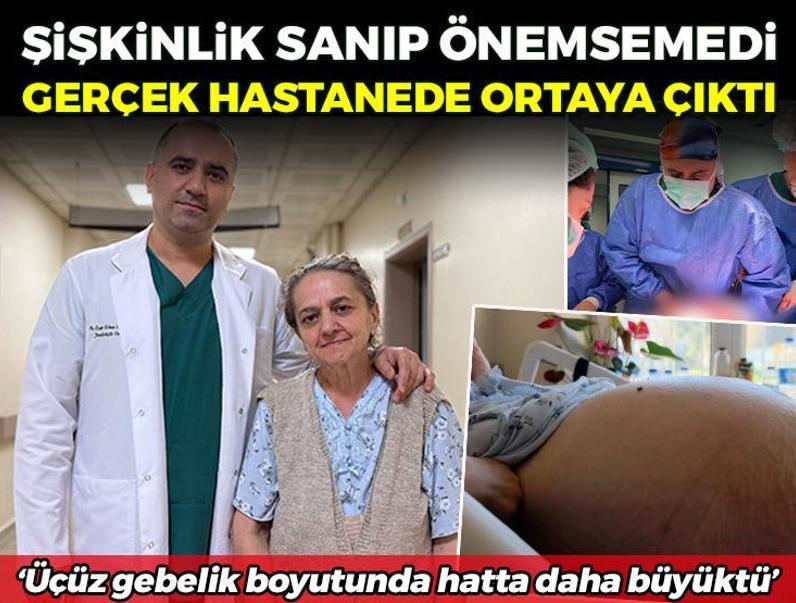 Kabızlık şişkinliği sandı, karnından tam 22 kilo tümör çıktı! Ameliyattan önce 79 kilo olan kadın 57'ye kadar düştü