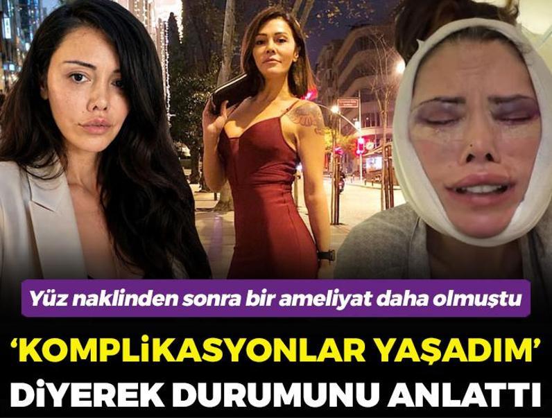 Yüz nakli sonrası bir ameliyat daha olmuştu! Didem Ceran yaşadıklarına isyan etti